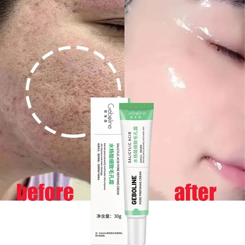 Skincare Salicylic Acid - Salicylzuur Porie Krimpende Crème Snelle Eliminatie