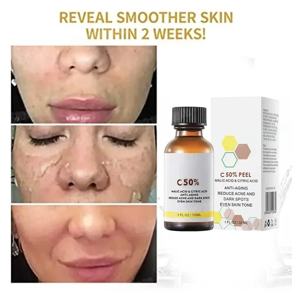 Salicylzuur Gezicht Gezichtspe - Skincare Salicylic Acid recensie en prijs