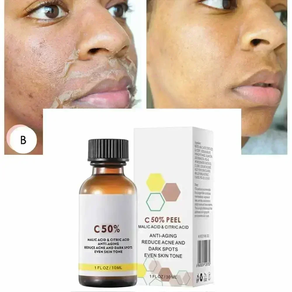 Salicylzuur Gezicht Gezichtspe - Skincare Salicylic Acid recensie en prijs