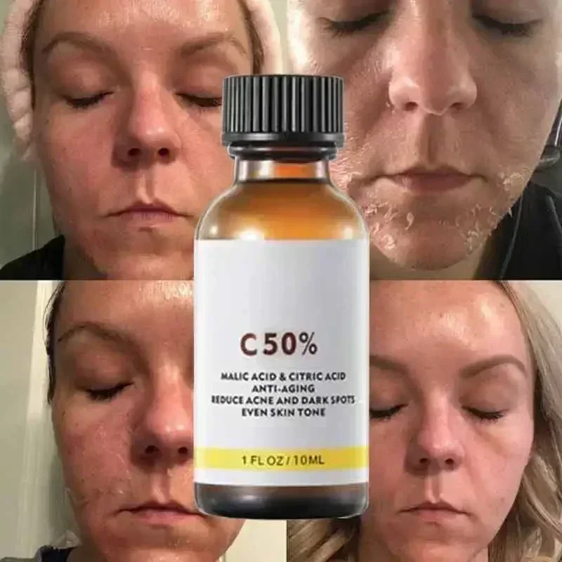 Salicylzuur Gezicht Gezichtspe - Skincare Salicylic Acid recensie en prijs