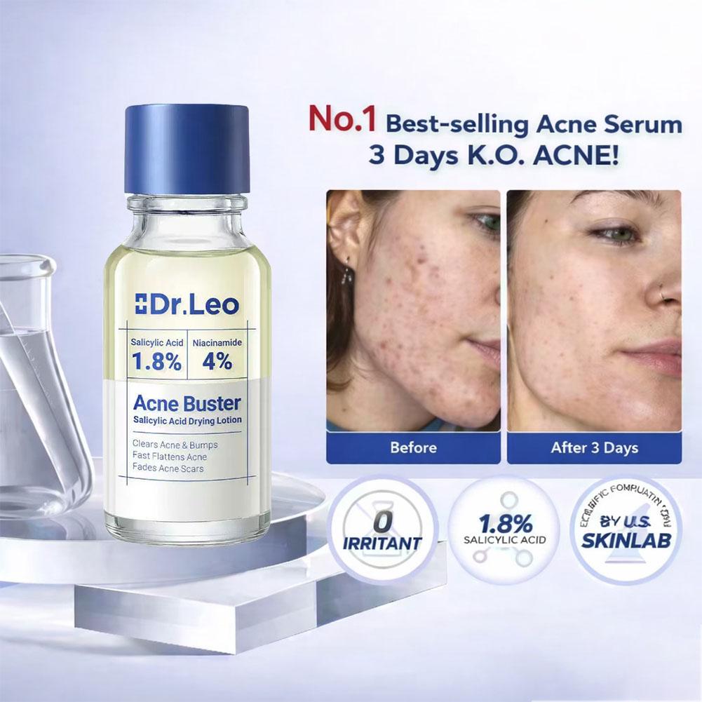 Salicylzuur Essence Behandelin - Skincare Salicylic Acid recensie en prijs