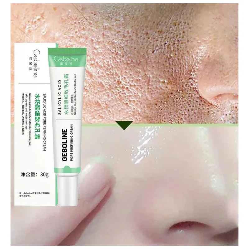 Salicylzuur Porie Krimpende Cr - Skincare Salicylic Acid recensie en prijs
