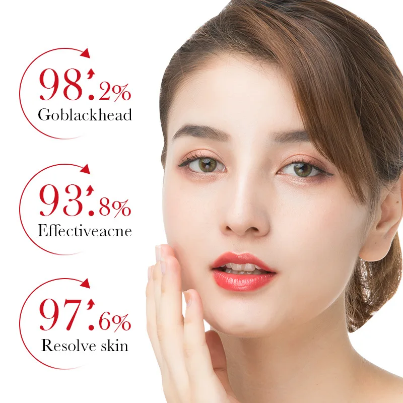 BIOAQUA Salicylzuur Acne Verwi - Skincare Salicylic Acid recensie en prijs