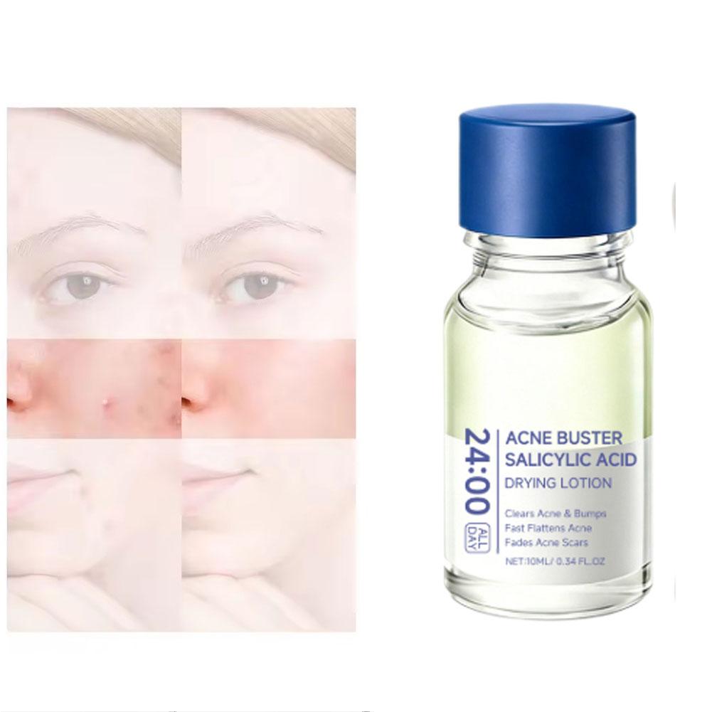 Salicylzuur Essence Behandelin - Skincare Salicylic Acid recensie en prijs