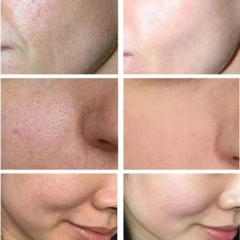Salicylzuur poriënverfijnende  - Skincare Salicylic Acid recensie en prijs