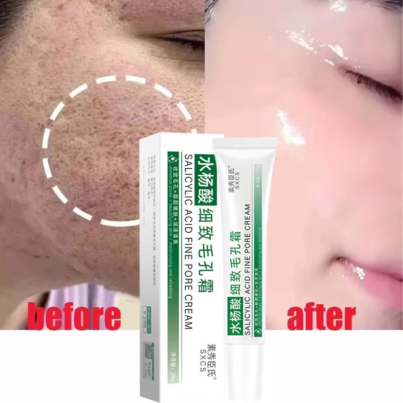 Salicylzuur poriënverfijnende  - Skincare Salicylic Acid recensie en prijs