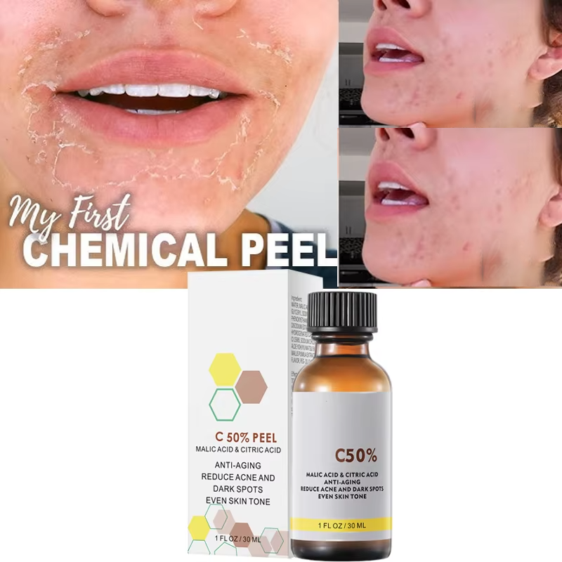 Met Maliczuur en Citroenzuur V - Skincare Salicylic Acid recensie en prijs